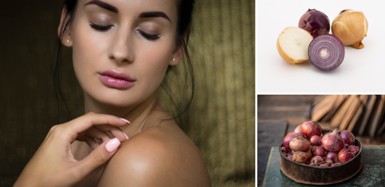 İltihap ve Sivilce İçin Soğan Kürü